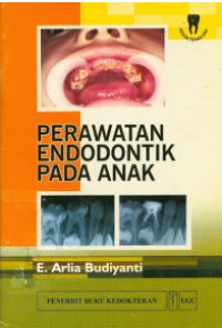 Image of Perawatan edodontik pada anak
