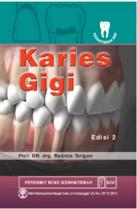 Image of Karies Gigi Edisi 2