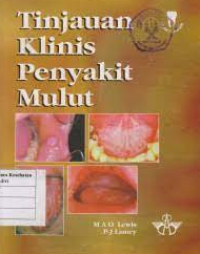 Image of Tinjauan Klinis Penyakit Mulut