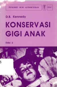 Image of Konservasi Gigi Anak