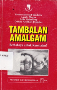 Image of Tambalan Amalgam Berbahaya untuk Kesehatan?