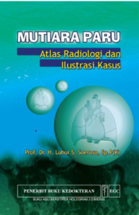 Image of Mutiara Paru: Atlas Radiologi dan Ilustrasi Kasus